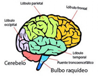 cerebro ictus